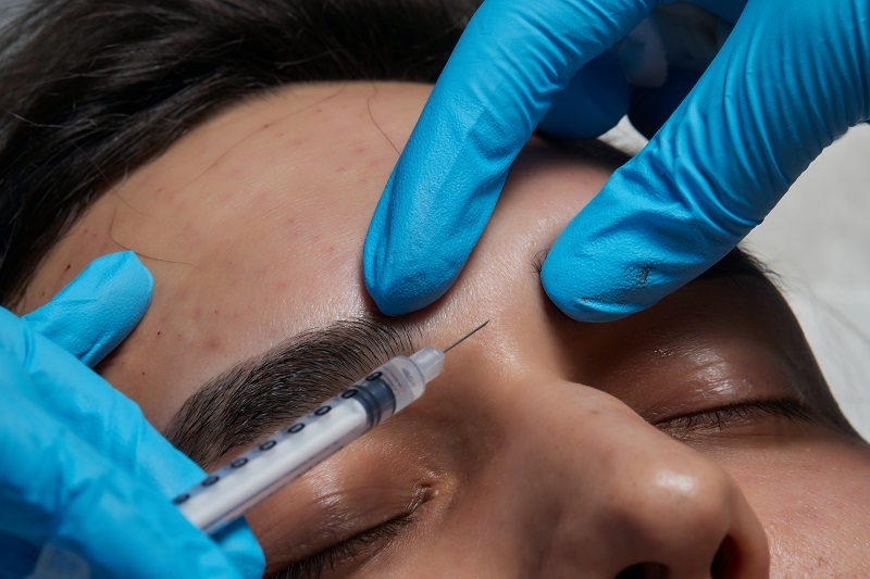 Les injections de toxine botulique ou botox dans le front